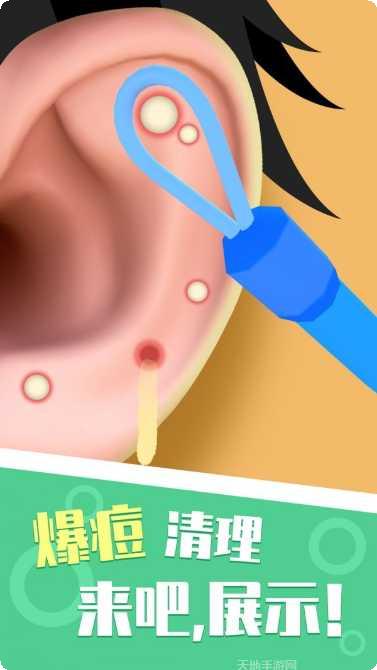 你是来掏耳屎的吧无限绿钞版破解