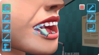 医生修个牙游戏下载