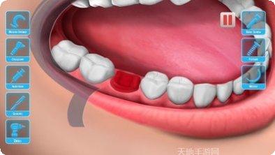 医生修个牙角色介绍